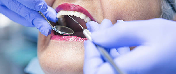 Best Walk-In Emergency Dentist in Castle Pines Village, CO